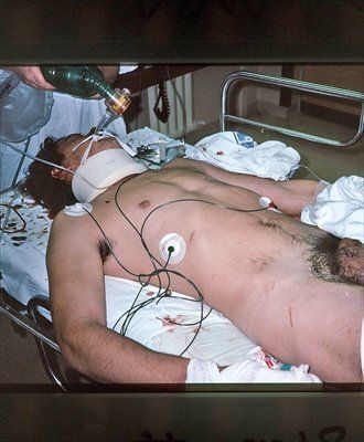 Fx.BasalskullFx.Bloodinear.MBA.20yoM.3.jpg