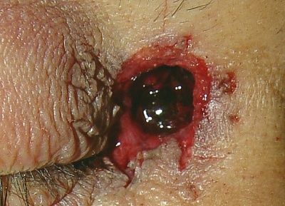 injury-20incoming-20projectile-20gun-20fired-20at-20close-20range.jpg