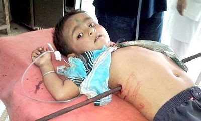 india_injured_child_989596x.jpg