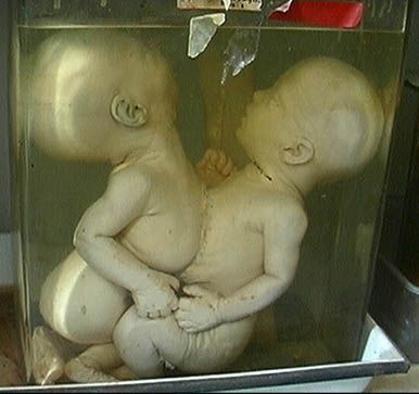 baby4.jpg