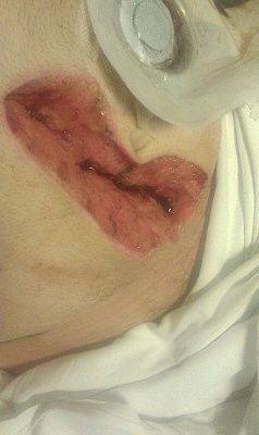 josh-27s-20gash-201.jpg