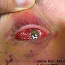 eye1.jpg