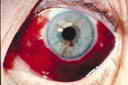 eye3.jpg