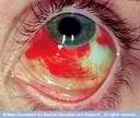 eye4.jpg