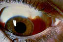 eye5.jpg