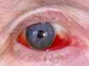 eye6.jpg