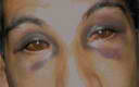 eye8.jpg