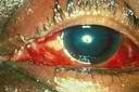 eye10.jpg