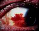 eye11.jpg