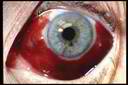 eye12.jpg