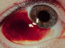 eye13.jpg