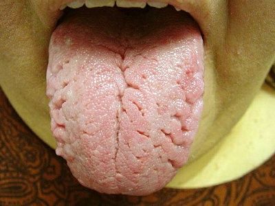 scrotal_tongue379.jpg