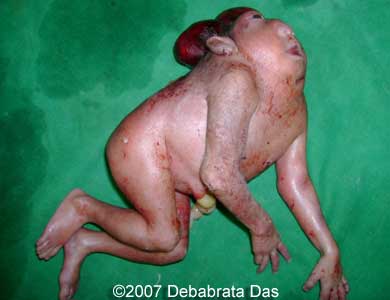 baby-born-no-brain-002.jpg
