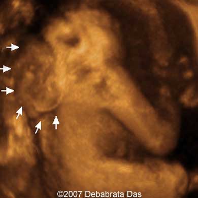 baby-born-no-brain-001.jpg