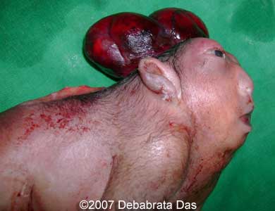 baby-born-no-brain-004.jpg