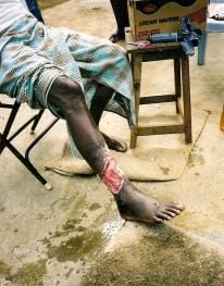leg1.jpg