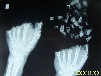 222449bujmnzfjyqxlbymm.jpg