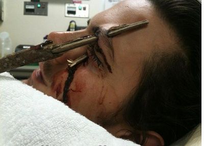 25-stick-pierced-eye.jpg