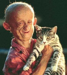 Hutchinson-Gilford Progeria Syndrome: Progeria Baby, Progeria Life Expectancy - progeria1