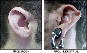 Ear_Collapse-1.jpg