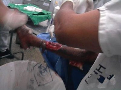 leg-20injury-20-281-29.jpg