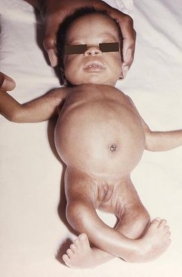 deform-20baby.jpg