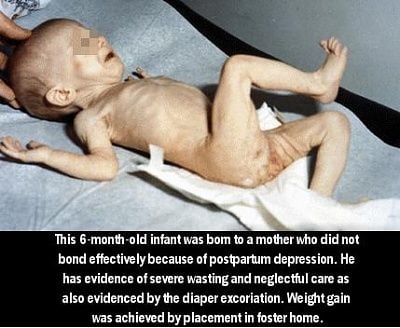 neglectedchild.jpg