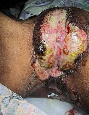 yuck3.jpg
