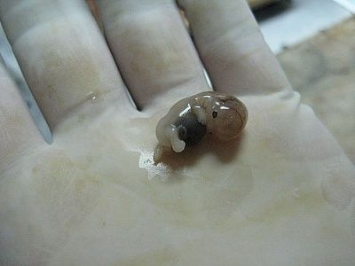 fetus.jpg