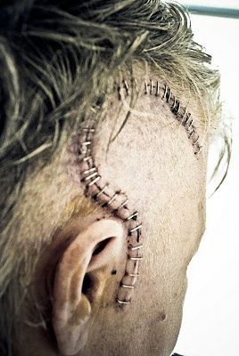 medical-staples-1.jpg