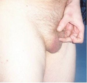 photos-of-men-with-small-penises-small-penis-photo-52-300x287.jpg