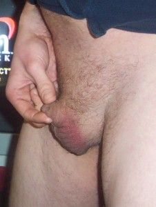 photos-of-men-with-small-penises-small-penis-photo-53-226x300.jpg