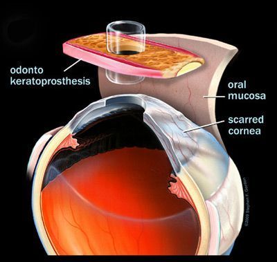 eye4.jpg