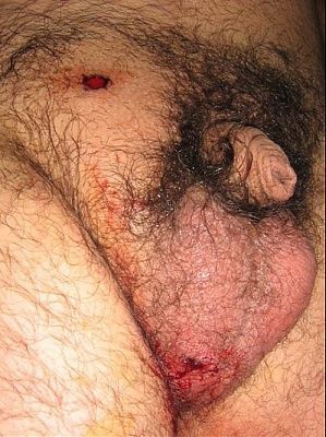 testicle.jpg