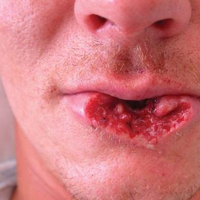 lip.jpg