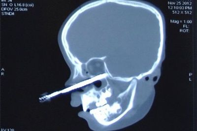 xray-20-281-29.jpg