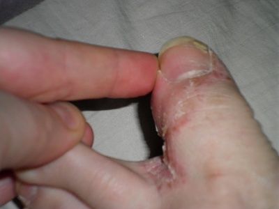 foot-20thing-20003.jpg