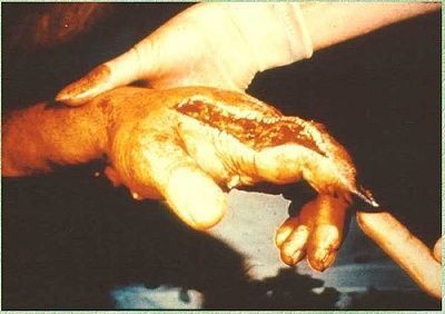 hand.jpg