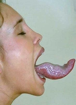 freakishly-large-tongue.jpg