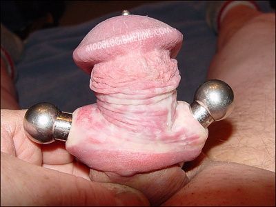 genital-indicators-large.jpg