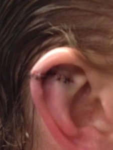 matt-hendricks-ear-2.jpg