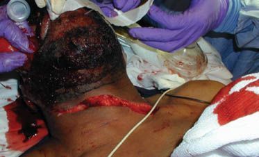 neck%20trauma.jpg