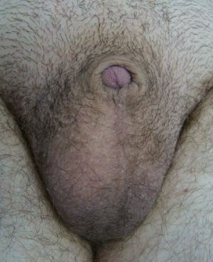 Name:  tr1.jpg
Views: 1992
Size:  22.2 KB
