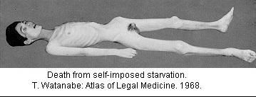 anorexic death.jpg