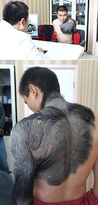 a98421_birthmark_1-zhang.jpg
