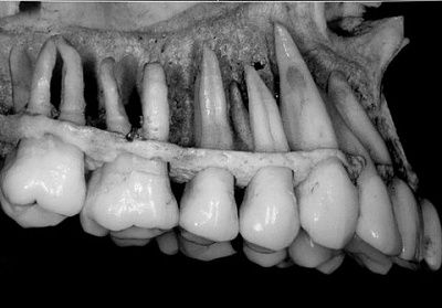 human-20teeth.jpg