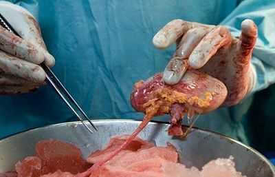 kidney-20translapnt.jpg