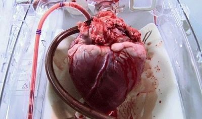 heart.jpg