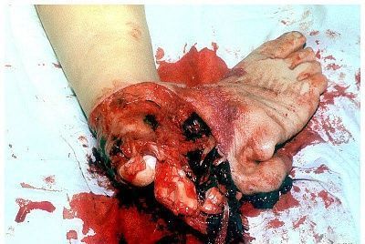 footsie.jpg