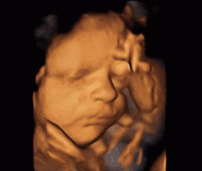 baby-20yawning.gif